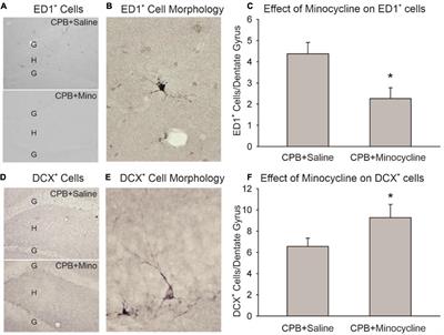 Suppression of Neuroinflammation Attenuates Persistent Cognitive and Neurogenic Deficits in a Rat Model of Cardiopulmonary Bypass